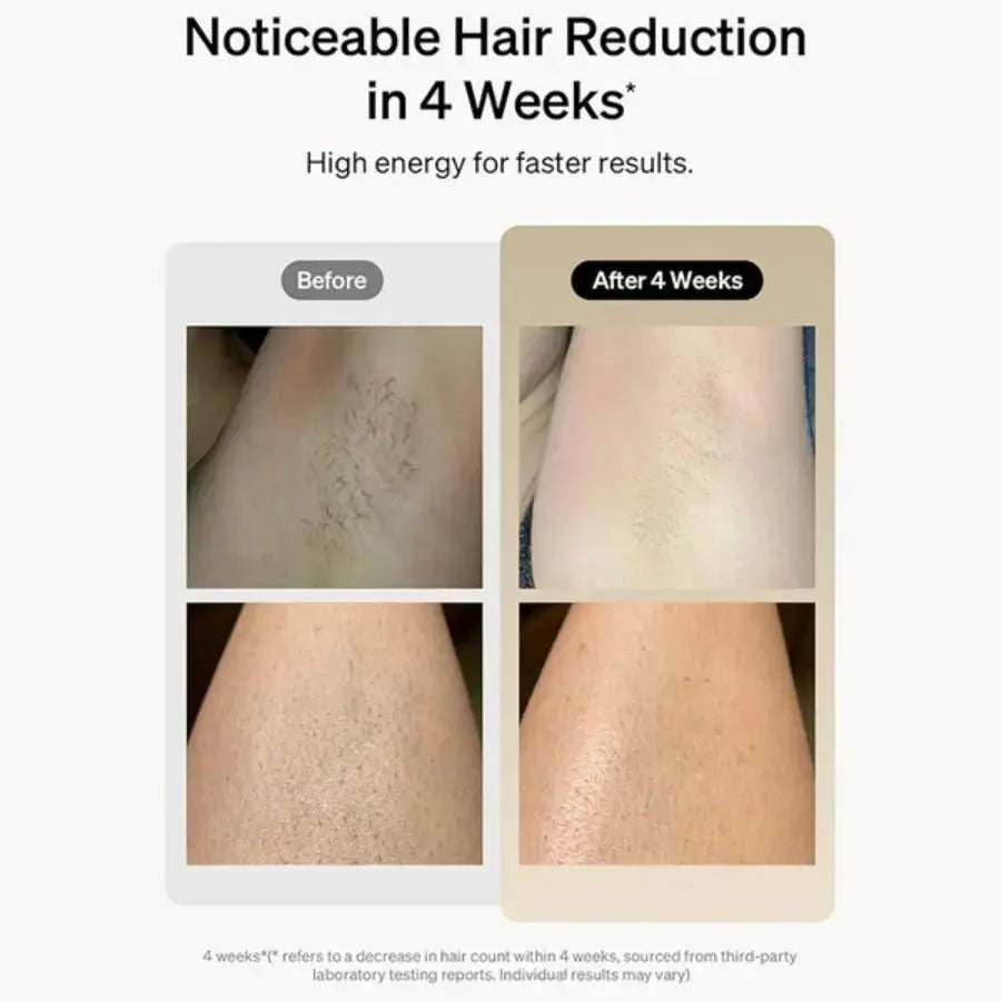Professional Laser Epilator IPL Hair Removal Body Bikini Leg Depilatory Devic 900,000 Flashes 5 Levels Epilator Painless Electric Epilator Machine Doba