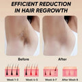 Professional Laser Epilator IPL Hair Removal Body Bikini Leg Depilatory Devic 900,000 Flashes 5 Levels Epilator Painless Electric Epilator Machine Doba