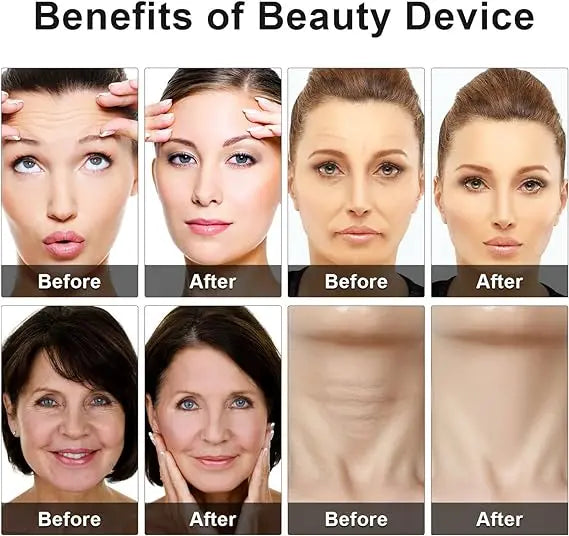 Eye Beauty Device Cato Collection